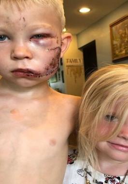 شاهدوا: طفل يتصدى لـ