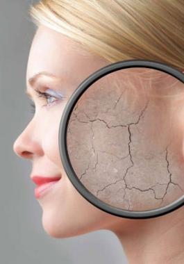 ترطيب البشرة الجافة