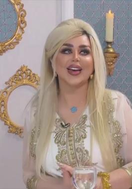 صور داليا نعيم قبل التجميل