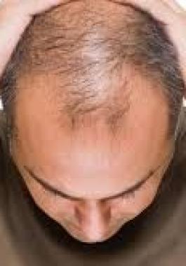 شاهدوا | الكشف عن 