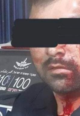 الاحتلال ينظر اليوم بتمديد اعتقال شابيْن تصديا للشرطة الإسرائيلية في كفر قاسم