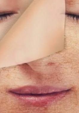 علامات تحذيرية لجفاف بشرة وجه