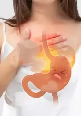 10 علاجات منزلية لتهدئة حرقة المعدة