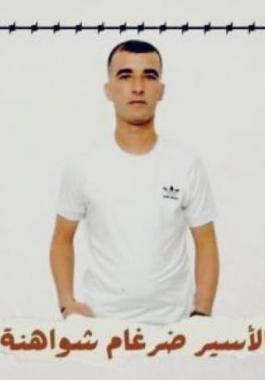 الاسير ضرغام شواهنة