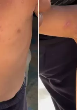 الأمراض الجلدية غزة