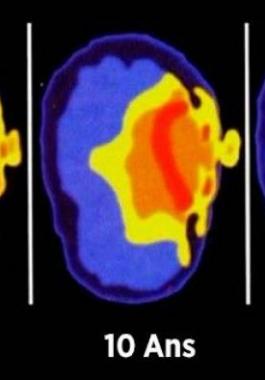 voici-ce-que-font-les-smartphones-sur-le-cerveau-des-enfants-jpg-64406164366508817