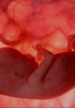 160706071437230-feutus_343677_large