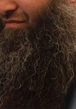 طرد طبيب بسبب لحيته