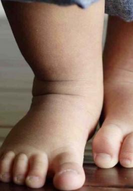 flat-feet-in-children-may-need-attention1-980x490