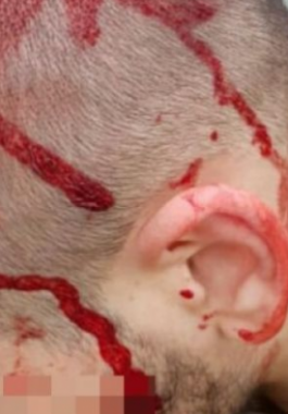 إصابة 11 جنديًا إسرائيليًا في شجار بقاعدة عسكرية.png