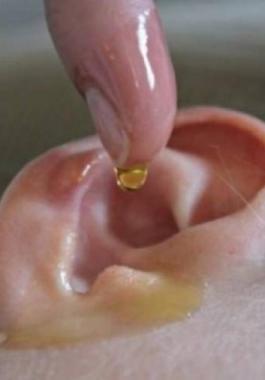 لن تصدق ماذا يحصل بعد وضع قطرات الزيت داخل الأذن؟