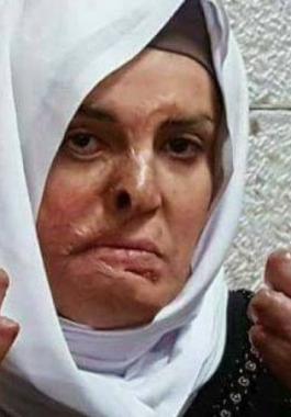 نقل الأسيرة جعابيص لمشفى 