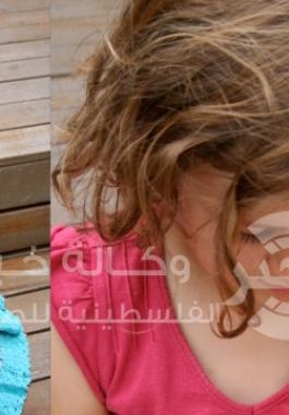 حساسية الجلد