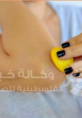 إزالة البقع الداكنة