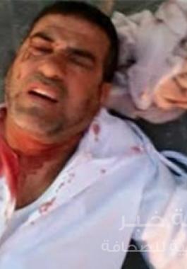 عماد أبو شرخ 