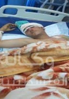 جرخى في اليمن