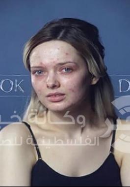 تبدين مقرفة 