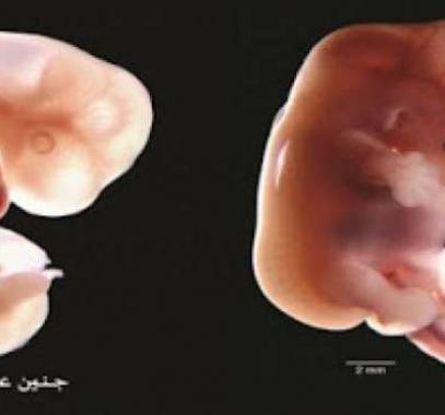 بالفيديو : متى ينفخ الروح في الجنين ؟