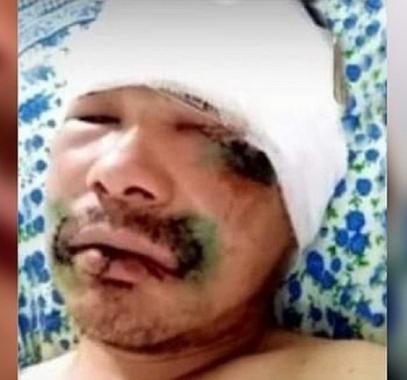 رجل قطع لسان دب لينجو منه