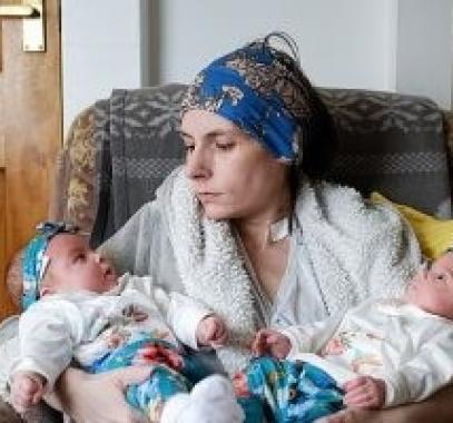 سيدة بريطانية تتغذى من أنبوب منذ 10 سنوات تنجب طفلتين