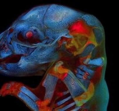 صورة مخيفة لجنين جرذ متوهج أحمر العين تفوز بجائزة التصوير العلمي المرموقة