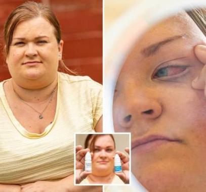 بريطانية تغلق عينها بعد وضع صمغ الأظافر بها بالخطأ.