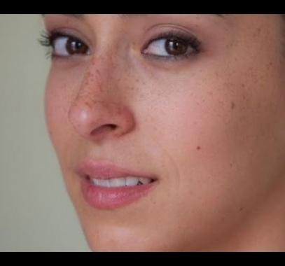 وصفات طبيعية لإزالة النمش من الوجه