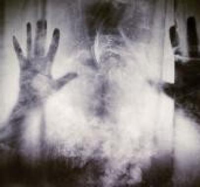 رؤية النائم