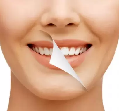 تنظيف الأسنان عند الطبيب بانتظام..الإيجابيات والسلبيات