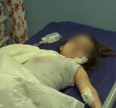 العراق.. دب ينهش ذراع طفلة في حديقة حيوانات