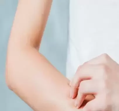 الحساسية والحالة النفسية