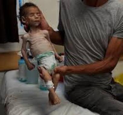 تنزيل (23).jpeg