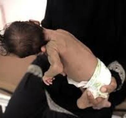 تنزيل (17).jpeg