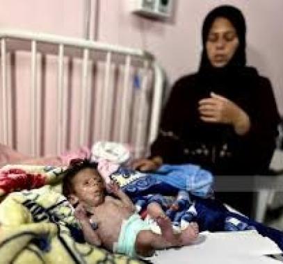 تنزيل (20).jpeg