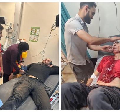 إصابات في اعتداء للمستعمرين في بلدة بيتا