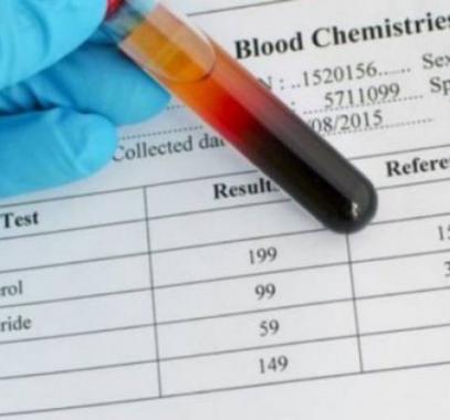 gf-jpg-84181646224930147