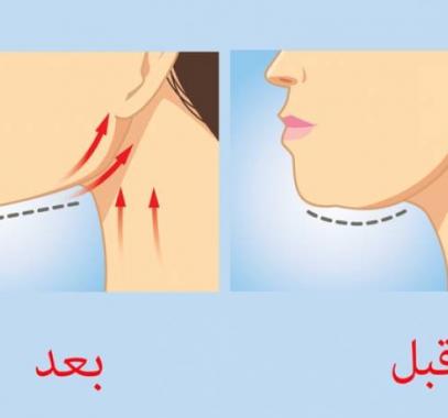 تخلص من الذقن المزدوج بهذه المادة السحرية الفعالة!