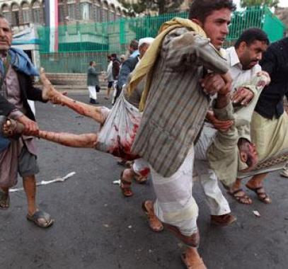قتلى في اليمن 