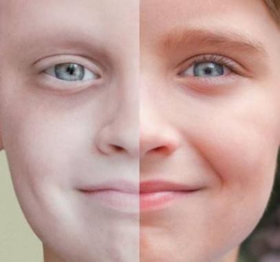 ht-cancer-split-sr-140521-16x9-992-jpg-58515749111190929