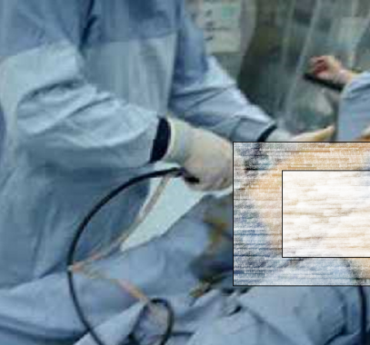 بالفيديو : دخلت في غيبوبة بعد عملية شفط دهون.. عندما استيقظت كانت المصيبة!