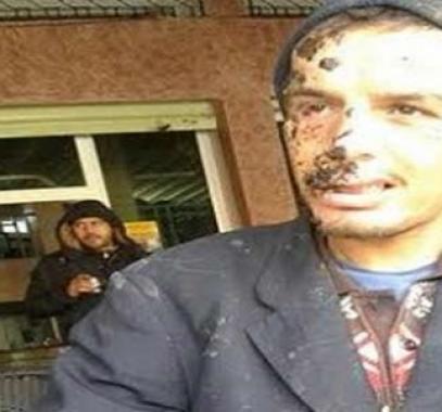 مغربي يُصاب بأغرب مرض .. الإرتفاع ثم السقوط!