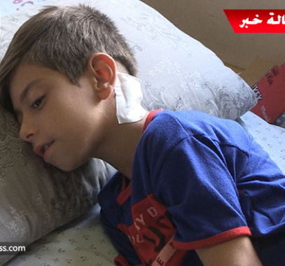 بالفيديو: عملية جراحية نوعية بغزّة أنقذت حياة طفل وأعادت الابتسامة لعائلته 