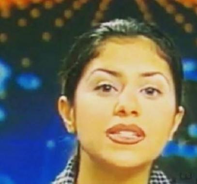 بالصور : لن تصدقوا من هذه النجمة العربية قبل عمليات التجميل!