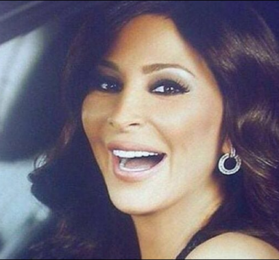بالصورة : إليسا تكشف عن العملية التي أجرتها في وجهها