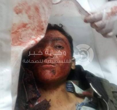 كيف جر جنود الاحتلال ولدًا في الثامنة لأكثر من ساعة في الخليل؟.jpg