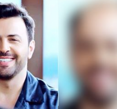 بالصور : 'كارثية' ماذا لو كان نجومنا العرب يعانون من الصلع‎‎؟