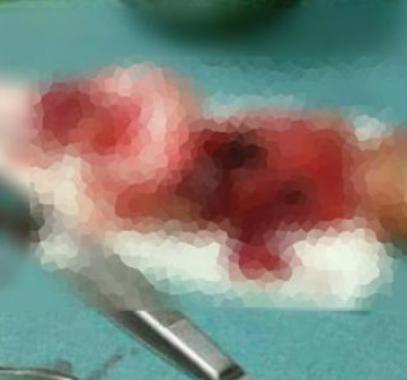 سيدة سورية تفقد جنينها جراء قصف شرق حلب