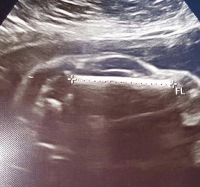 11-jpg-14544651147868402