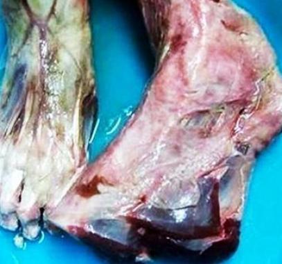 صدمة.. قدم بشرية مقطوعة في مطعم صيني