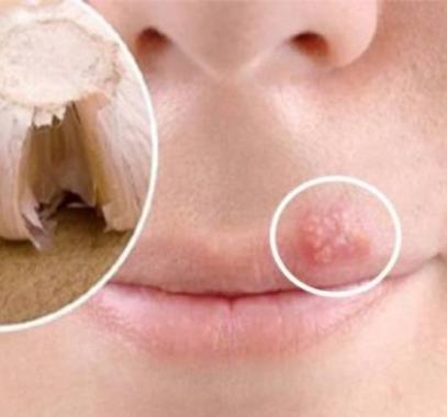 2-jpg-99495546292170355_718151_large